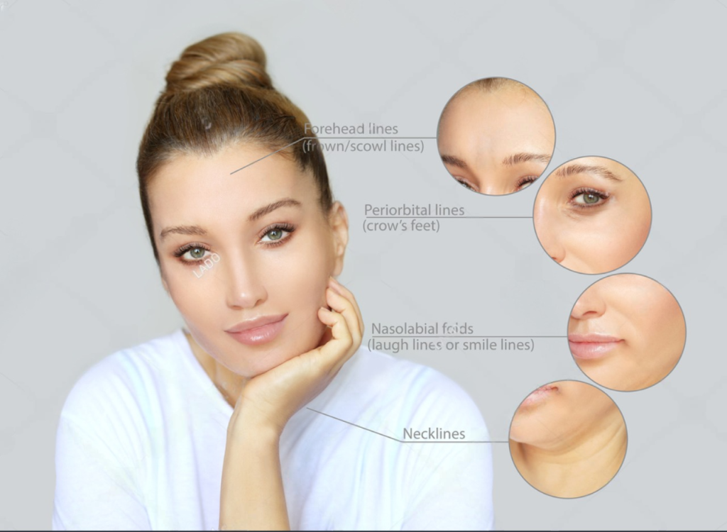 Botox wajah adalah salah satu prosedur kosmetik paling populer di dunia. Metode ini dikenal efektif dalam mengurangi keriput dan garis halus, memberikan tampilan yang lebih segar dan awet muda.